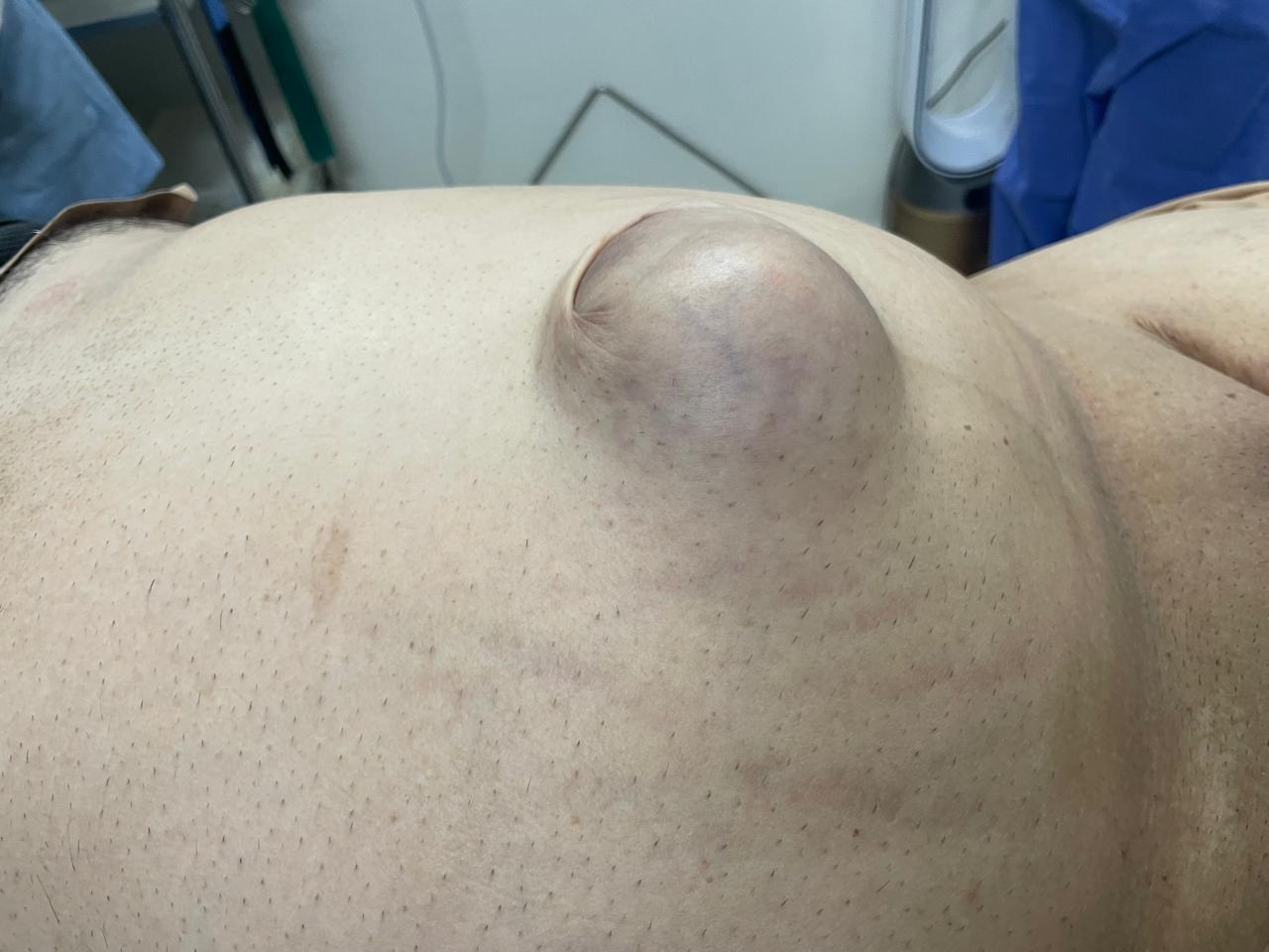 Before