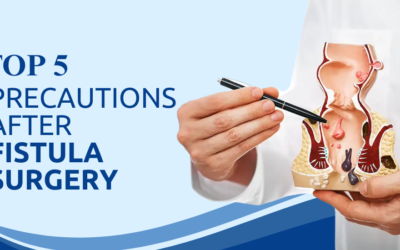 Top 5 Precautions After Fistula Surgery