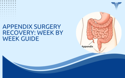 Appendix Surgery Recovery: Week by Week Guide