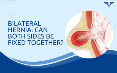 Bilateral Hernia: Can Both Sides Be Fixed Together?