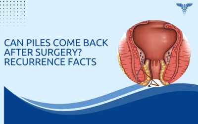 Can Piles Come Back After Surgery? Recurrence Facts