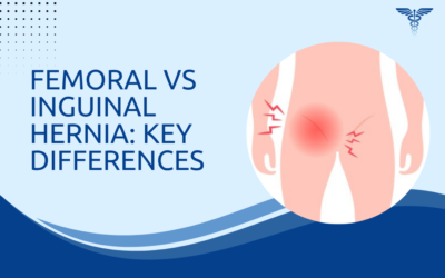 Femoral vs Inguinal Hernia: Key Differences