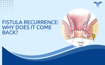 Fistula Recurrence: Why Does It Come Back?