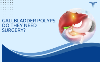 Gallbladder Polyps: Do They Need Surgery?