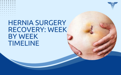 Hernia Surgery Recovery: Week by Week Timeline