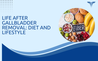 Life After Gallbladder Removal: Diet and Lifestyle