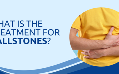 What Is the Treatment for Gallstones, Really?