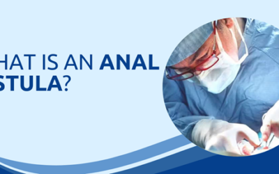 What Is Anal Fistula, Actually?