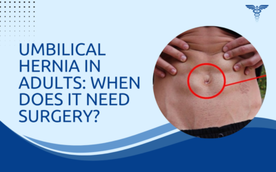 Umbilical Hernia in Adults: When Does It Need Surgery?