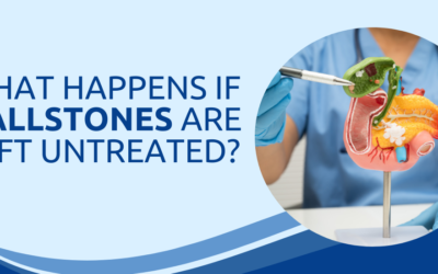 What Happens if Gallstones Are Left Untreated?