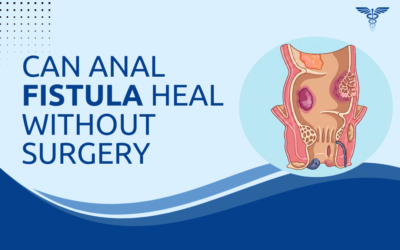 Can Anal Fistula Heal Without Surgery?