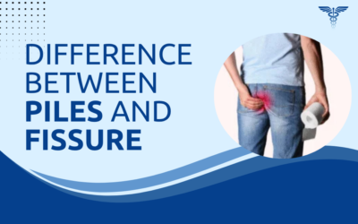 Difference Between Piles and Fissure