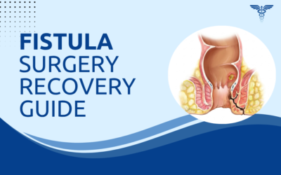 Fistula Surgery Recovery: Diet and Activity Guide?