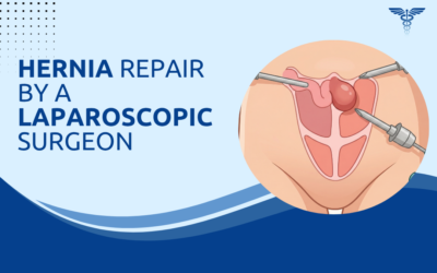Hernia Repair by a Laparoscopic Surgeon