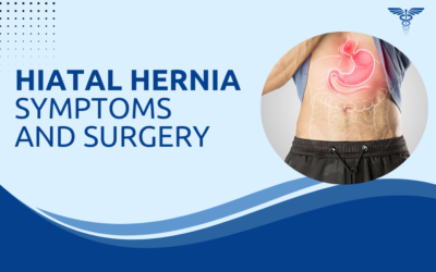 How Long Does Laparoscopic Hernia Surgery Take?