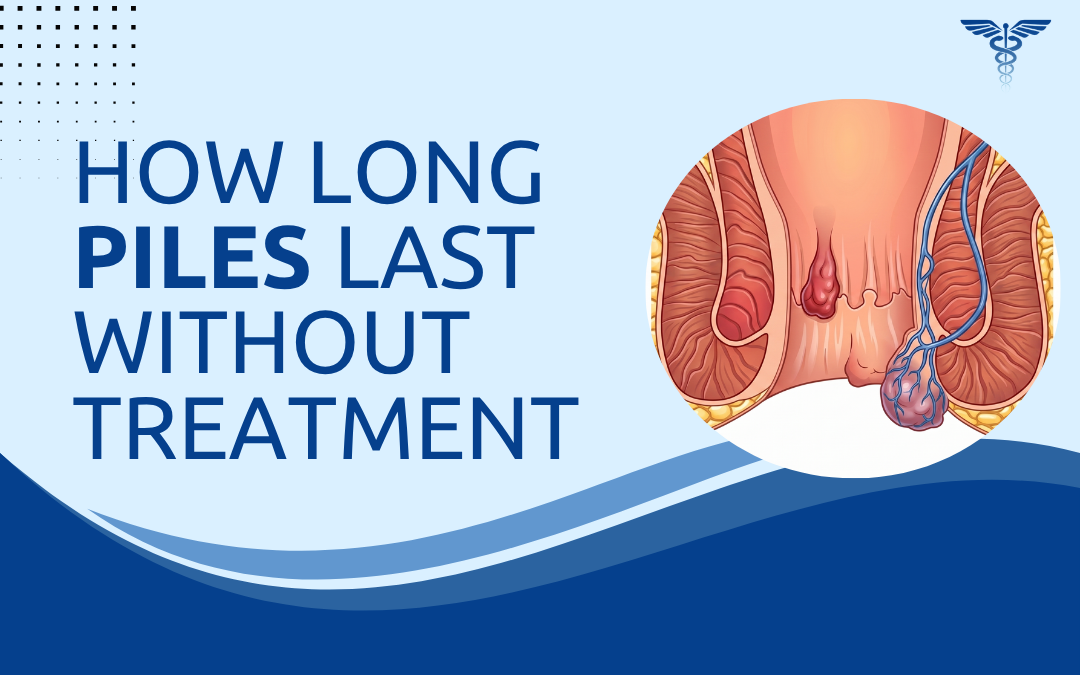 How Long Piles Last Without Treatment