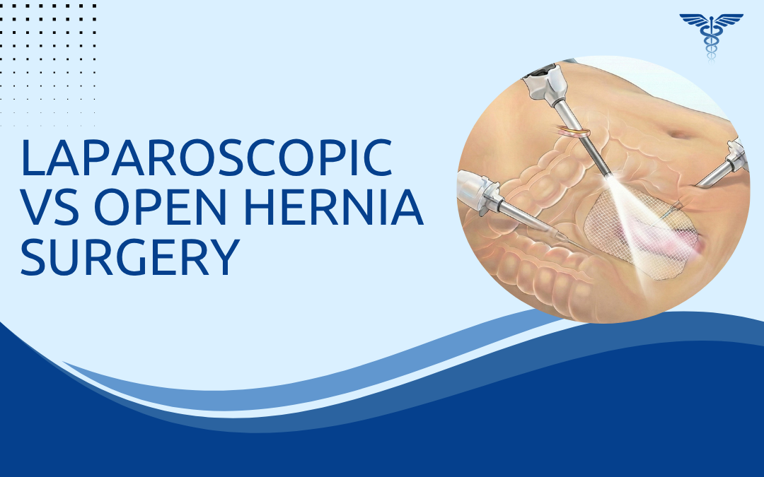Laparoscopic vs Open Hernia Surgery