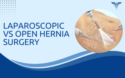 Laparoscopic vs Open Hernia Surgery: Safety and Outcome Compared