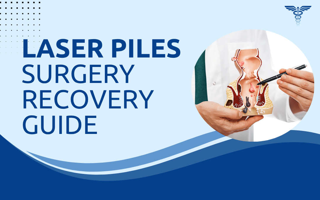 Laser Piles Surgery Recovery Guide