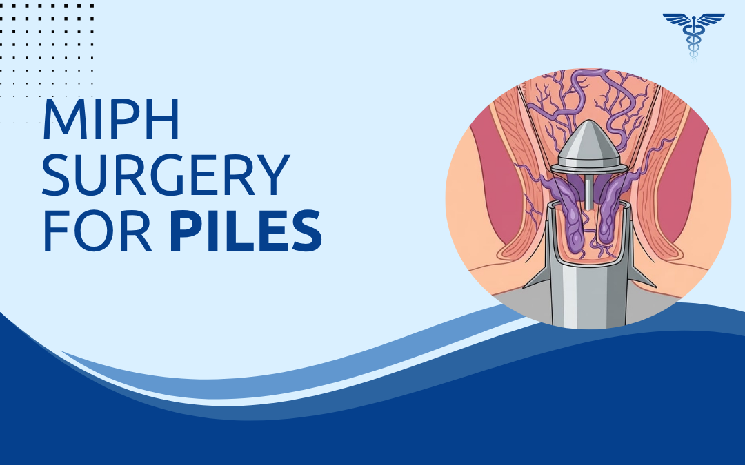 MIPH Surgery for Piles