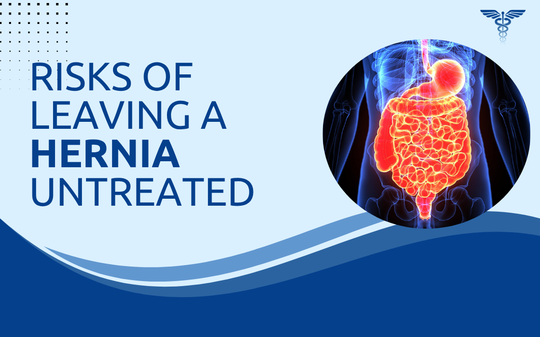 Risks of Leaving a Hernia Untreated