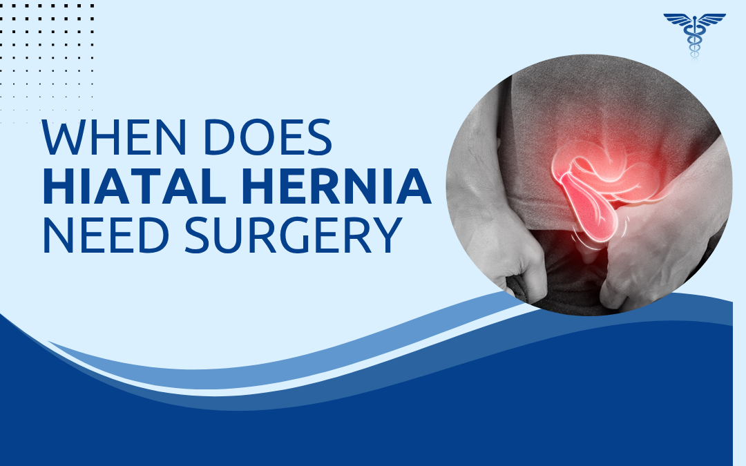 When Does Hiatal Hernia Need Surgery