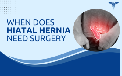 What Is a Hiatal Hernia and When Does It Need Surgery?
