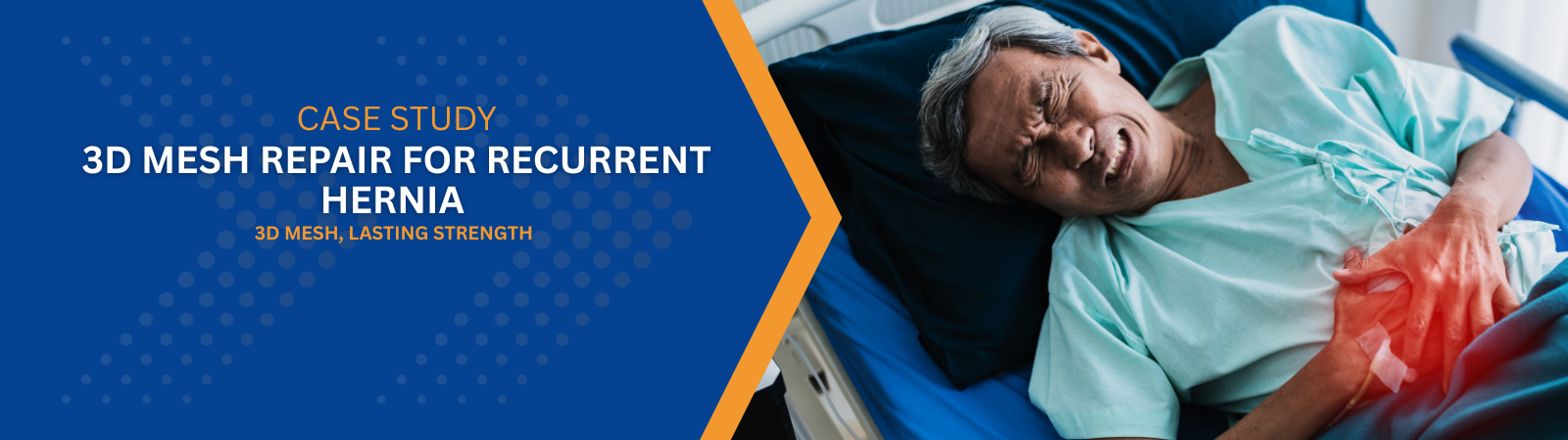 Case study banner for 3D mesh repair of recurrent hernia, with blue left panel and a patient in a hospital showing abdominal pain on the right (red highlighted area).