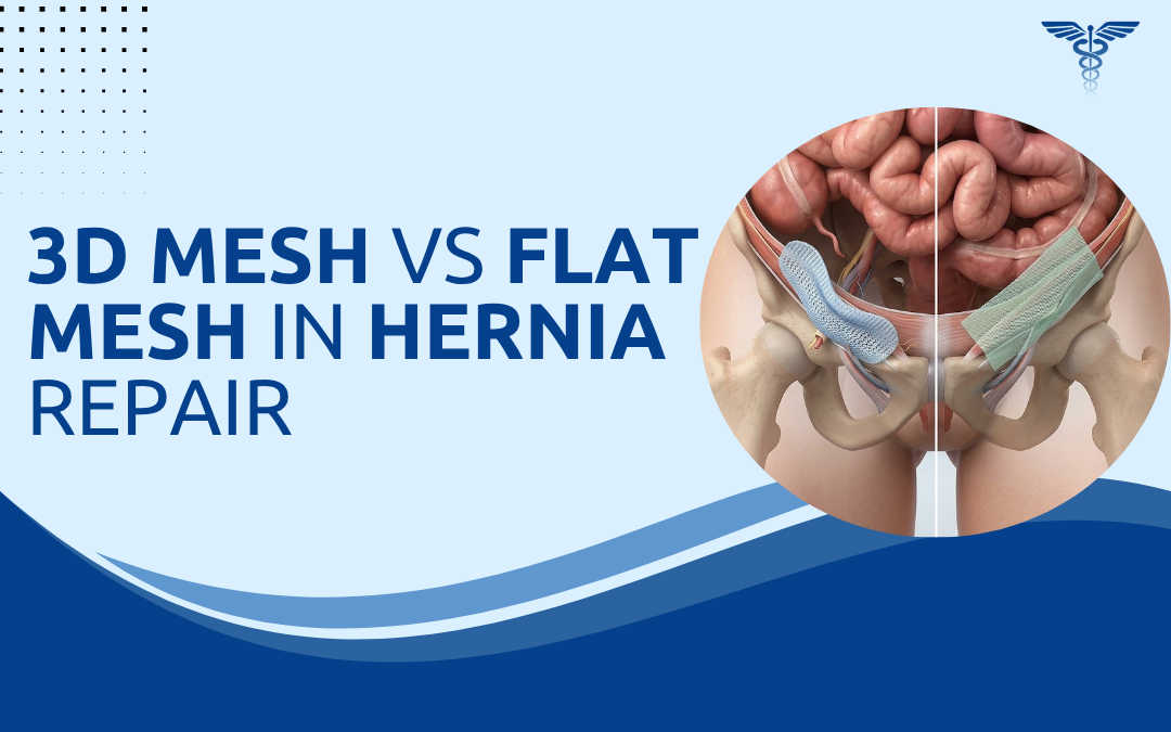 3D Mesh vs Flat Mesh in Hernia Repair
