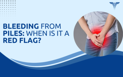 Bleeding From Piles: When Is It a Red Flag?