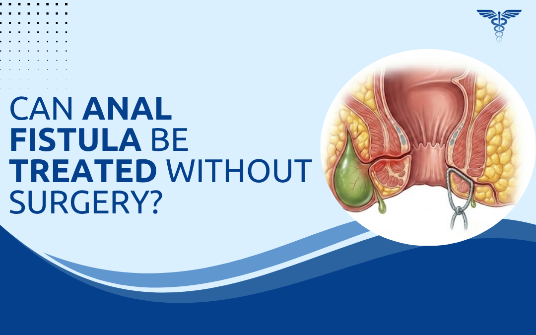 Can Anal Fistula Be Treated Without Surgery