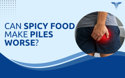 Can Spicy Food Make Piles Worse?