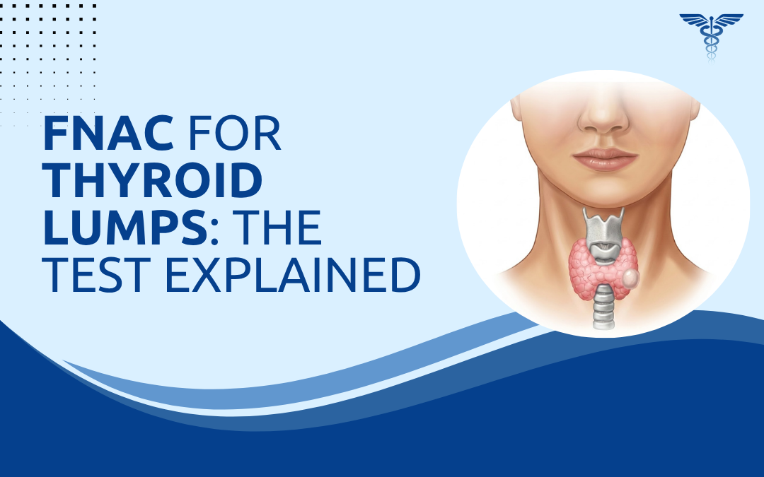 FNAC for Thyroid Lumps The Test Explained