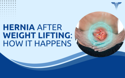 Hernia After Weight Lifting: How Does It Happen?