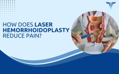 How Does Laser Hemorrhoidoplasty Reduce Pain?