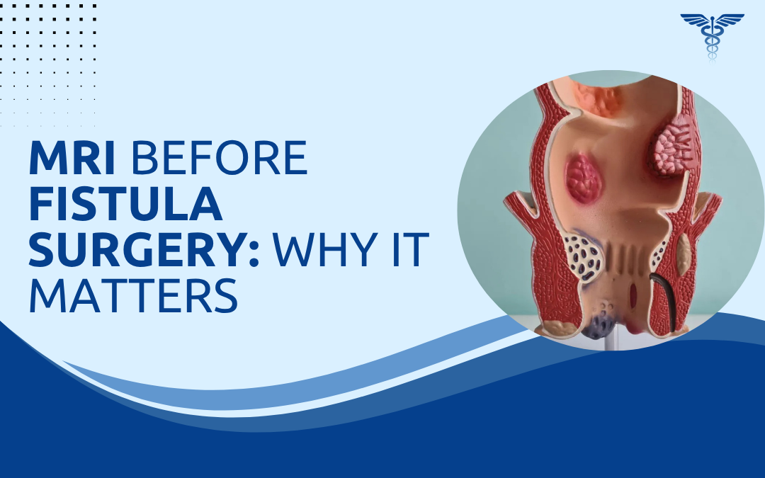 MRI Before Fistula Surgery Why It Matters