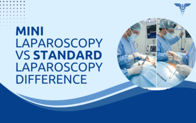 Mini Laparoscopy vs Standard Laparoscopy: What Is the Difference?