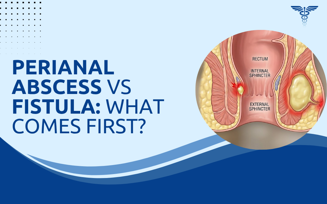 Perianal Abscess vs Fistula What Comes First