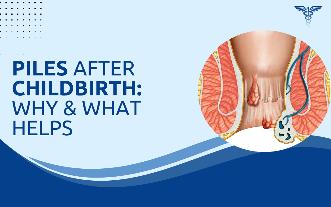 Piles After Childbirth Why & What Helps