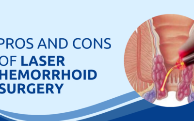 Pros and Cons of Laser Hemorrhoid Surgery