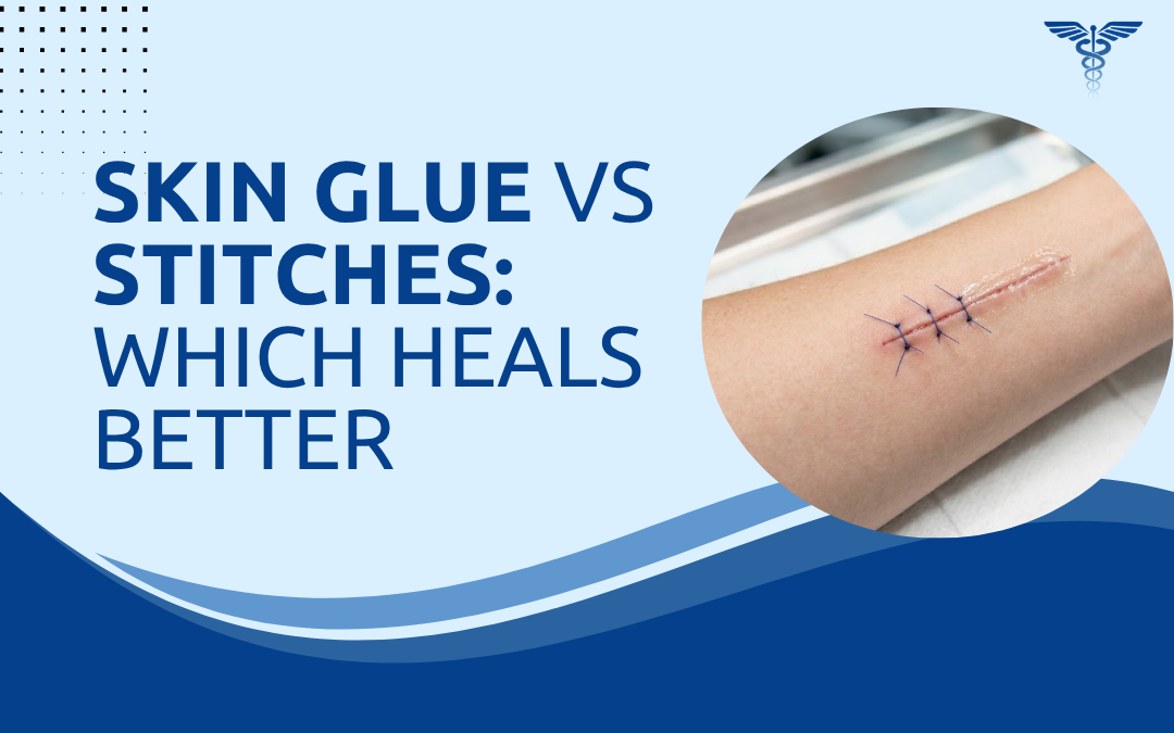 Skin Glue vs Stitches Which Heals Better
