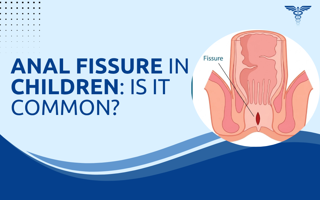 Anal Fissure in Children Is It Common