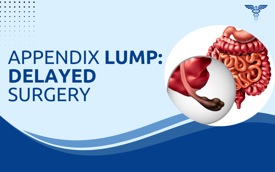 Appendix Lump Delayed Surgery