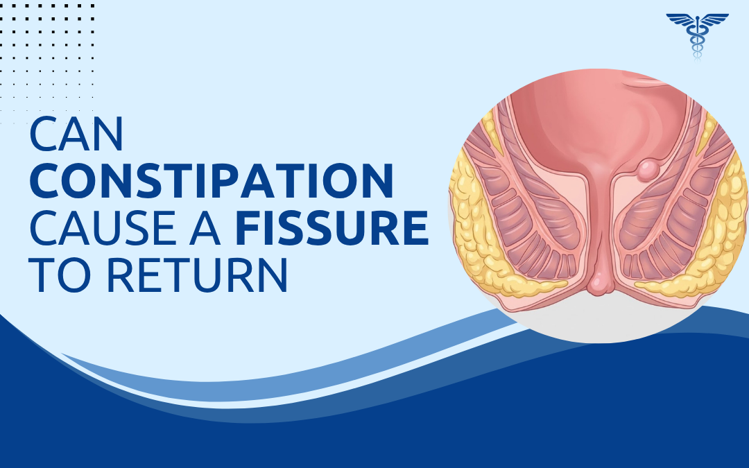 Can Constipation Cause a Fissure to Return