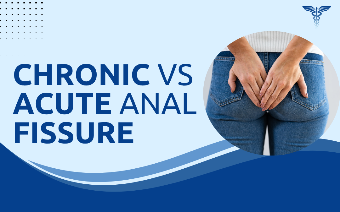 Chronic vs Acute Anal Fissure