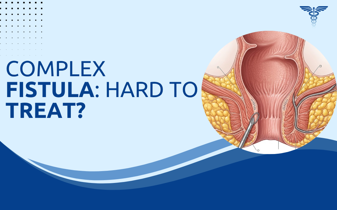 Complex Fistula Hard to Treat
