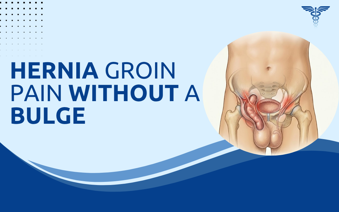 Hernia Groin Pain Without a Bulge