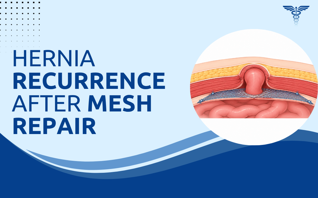 Hernia Recurrence After Mesh Repair