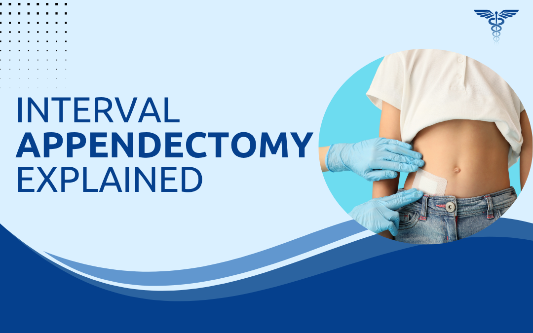 Interval Appendectomy Explained