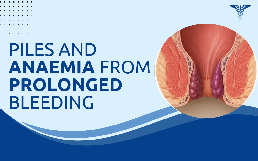 Piles and Anaemia From Prolonged Bleeding